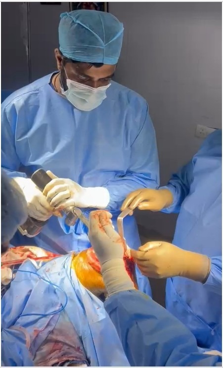 Intra-operative joint reconstruction and soft tissue balancing during knee arthroplasty